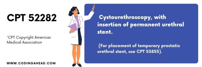 Cpt code for cyst aspiration